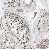 Anti-ERBB4 antibody produced in rabbit Prestige Antibodies&#174; Powered by Atlas Antibodies, affinity isolated antibody, buffered aqueous glycerol solution