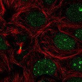 Anti-RBM18 antibody produced in rabbit Prestige Antibodies&#174; Powered by Atlas Antibodies, affinity isolated antibody, buffered aqueous glycerol solution