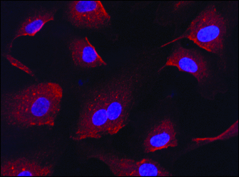 Anti-RanGAP1 (C-terminal) antibody produced in rabbit ~1&#160;mg/mL, affinity isolated antibody, buffered aqueous solution