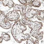Monoclonal Anti-MYO10 antibody produced in mouse Prestige Antibodies&#174; Powered by Atlas Antibodies, clone CL9032, purified immunoglobulin, buffered aqueous glycerol solution
