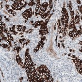 Monoclonal Anti-KRT7 antibody produced in mouse Prestige Antibodies&#174; Powered by Atlas Antibodies, clone CL8725, purified immunoglobulin, buffered aqueous glycerol solution