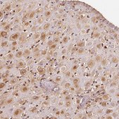 Anti-IGFBP1 antibody produced in rabbit Prestige Antibodies&#174; Powered by Atlas Antibodies, affinity isolated antibody, buffered aqueous glycerol solution