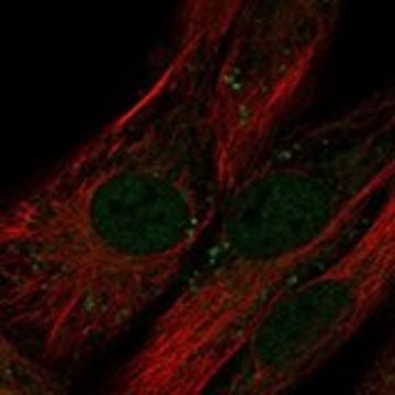 Anti-LRRC17 antibody produced in rabbit Prestige Antibodies&#174; Powered by Atlas Antibodies, affinity isolated antibody, buffered aqueous glycerol solution