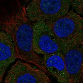 Anti-STARD5 antibody produced in rabbit Prestige Antibodies&#174; Powered by Atlas Antibodies, affinity isolated antibody, buffered aqueous glycerol solution