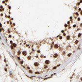 Anti-MED12 antibody produced in rabbit Ab1, Prestige Antibodies&#174; Powered by Atlas Antibodies, affinity isolated antibody, buffered aqueous glycerol solution