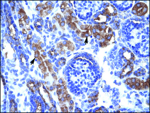 Anti-CHEK1 antibody produced in rabbit affinity isolated antibody