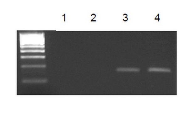 EZ-Magna ChIP&#174; G - Chromatin Immunoprecipitation Kit Single day chromatin immunoprecipitation (ChIP) kit containing all necessary reagents to perform 22 individual chromatin immunoprecipitation (ChIP) reactions using magnetic G beads. Control primers included.