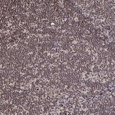 Anti-SNRPC antibody produced in rabbit Prestige Antibodies&#174; Powered by Atlas Antibodies, affinity isolated antibody, buffered aqueous glycerol solution