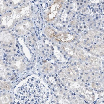 Anti-KIFC3 antibody produced in rabbit Prestige Antibodies&#174; Powered by Atlas Antibodies, affinity isolated antibody, buffered aqueous glycerol solution