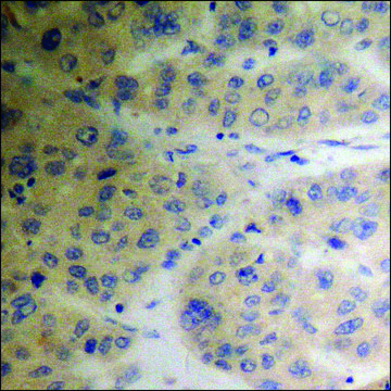 Anti-phospho-TIP60 (pSer86) antibody produced in rabbit affinity isolated antibody