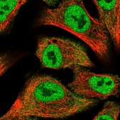 Anti-PRKD2 antibody produced in rabbit Prestige Antibodies&#174; Powered by Atlas Antibodies, affinity isolated antibody