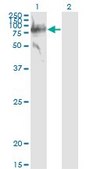 Monoclonal Anti-SERPING1 antibody produced in mouse clone 3F4-1D9, purified immunoglobulin, buffered aqueous solution