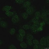 Anti-Lamin B Receptor (LBR) Antibody, clone BB2SS3F3 clone BB2SS3F3, from mouse