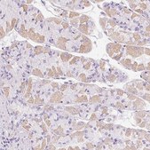 Anti-GSDMC antibody produced in rabbit Prestige Antibodies&#174; Powered by Atlas Antibodies, affinity isolated antibody, buffered aqueous glycerol solution, Ab3