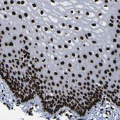 Anti-NPM1 antibody produced in rabbit Prestige Antibodies&#174; Powered by Atlas Antibodies, affinity isolated antibody, buffered aqueous glycerol solution