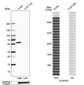 Anti-ALDH3A1 antibody produced in rabbit Prestige Antibodies&#174; Powered by Atlas Antibodies, affinity isolated antibody, buffered aqueous glycerol solution