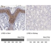 Anti-LY6D antibody produced in rabbit Prestige Antibodies&#174; Powered by Atlas Antibodies, affinity isolated antibody, buffered aqueous glycerol solution