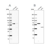 Anti-ZC3HC1 antibody produced in rabbit Prestige Antibodies&#174; Powered by Atlas Antibodies, affinity isolated antibody, buffered aqueous glycerol solution