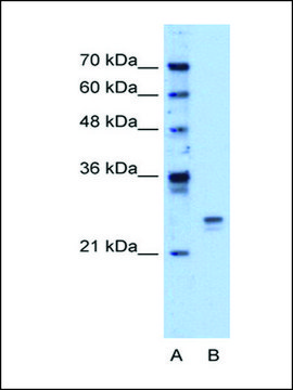 Anti-HMGB1 (AB2) antibody produced in rabbit IgG fraction of antiserum