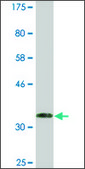 Monoclonal Anti-RRM2B antibody produced in mouse clone 6C1, ascites fluid
