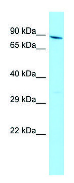 Anti-YTHDC1 (N-terminal) antibody produced in rabbit affinity isolated antibody