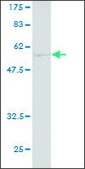 ANTI-CA1 antibody produced in mouse clone 1E11, purified immunoglobulin, buffered aqueous solution