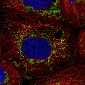 Anti-PTPMT1 antibody produced in rabbit Prestige Antibodies&#174; Powered by Atlas Antibodies, affinity isolated antibody, buffered aqueous glycerol solution