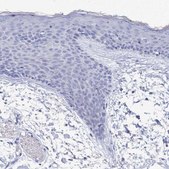 Anti-PDE4C antibody produced in rabbit Prestige Antibodies&#174; Powered by Atlas Antibodies, affinity isolated antibody, buffered aqueous glycerol solution