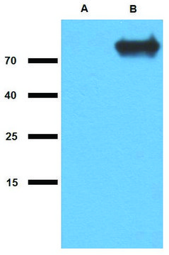 Anti-GlcB (M. tuberculosis) antibody produced in rabbit