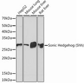 Anti-Sonic Hedgehog (Shh) antibody produced in rabbit