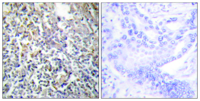 Anti-Fibronectin 1 antibody produced in rabbit affinity isolated antibody