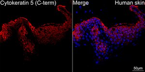 Anti-Cytokeratin 5 (KRT5) Antibody, clone 3P3T9, Rabbit Monoclonal