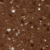 Anti-RTN3 antibody produced in rabbit Prestige Antibodies&#174; Powered by Atlas Antibodies, affinity isolated antibody, buffered aqueous glycerol solution