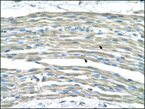 Anti-GPR161 antibody produced in rabbit affinity isolated antibody