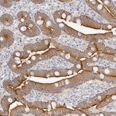 Anti-USH1C antibody produced in rabbit Prestige Antibodies&#174; Powered by Atlas Antibodies, affinity isolated antibody, buffered aqueous glycerol solution, ab3