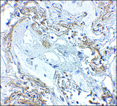 Anti-TNFAIP3 antibody produced in rabbit affinity isolated antibody, buffered aqueous solution, ab1