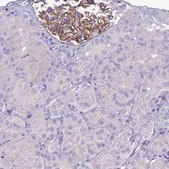 Anti-CRB2 antibody produced in rabbit Prestige Antibodies&#174; Powered by Atlas Antibodies, affinity isolated antibody, buffered aqueous glycerol solution