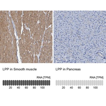 Anti-LPP antibody produced in rabbit Prestige Antibodies&#174; Powered by Atlas Antibodies, affinity isolated antibody, buffered aqueous glycerol solution