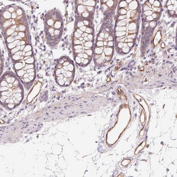 Anti-ANKRD13B antibody produced in rabbit Prestige Antibodies&#174; Powered by Atlas Antibodies, affinity isolated antibody, buffered aqueous glycerol solution