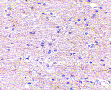 Anti-SATB2 (ab1) antibody produced in rabbit affinity isolated antibody, buffered aqueous solution