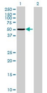 Anti-ASNS antibody produced in mouse purified immunoglobulin, buffered aqueous solution