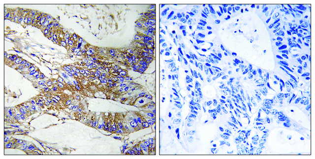 Anti-SERPINB9 antibody produced in rabbit affinity isolated antibody