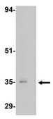 Anti-GPR Antibody3 from rabbit, purified by affinity chromatography