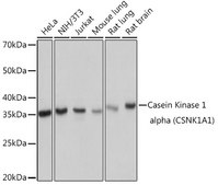 Anti-Casein Kinase 1 alpha (CSNK1A1) Antibody, clone 9O4L9, Rabbit Monoclonal