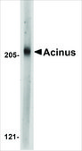 Anti-Acinus antibody produced in rabbit affinity isolated antibody, buffered aqueous solution