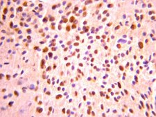 Anti-Olig-2 Antibody Chemicon&#174;, from rabbit