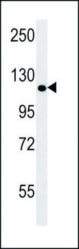 ANTI-POTEE (CENTER) antibody produced in rabbit IgG fraction of antiserum, buffered aqueous solution