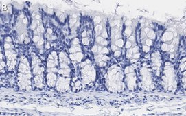 Anti-iNOS (NOSII) Antibody, clone 2G17 ZooMAb&#174; Rabbit Monoclonal recombinant, expressed in HEK 293 cells