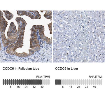 Anti-CCDC6 antibody produced in rabbit Prestige Antibodies&#174; Powered by Atlas Antibodies, affinity isolated antibody, buffered aqueous glycerol solution, Ab2