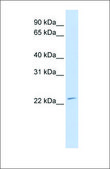 Anti-FGF21 antibody produced in rabbit affinity isolated antibody